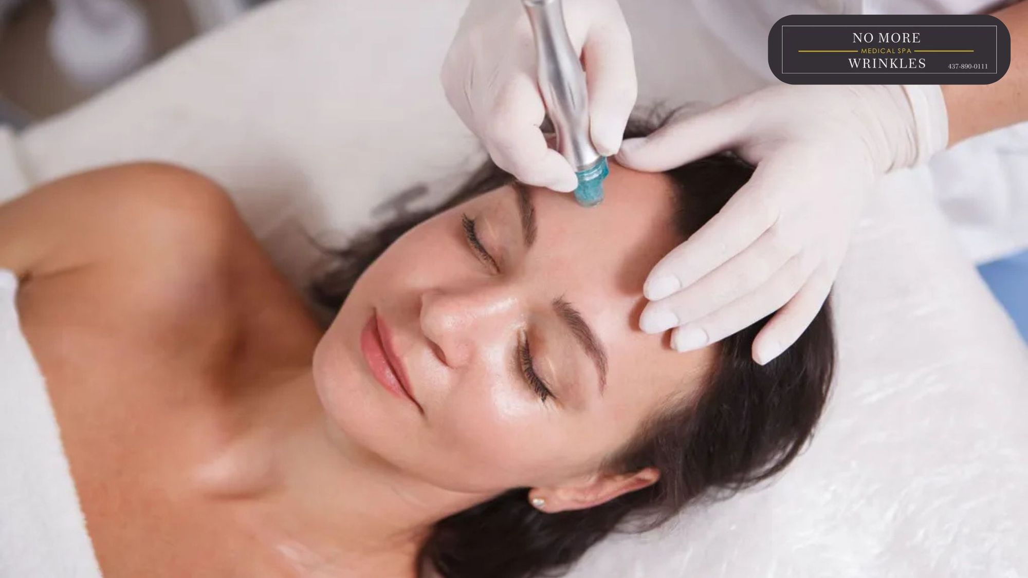 How to Fix Dull and Congested Skin: Benefits of Hydra Facial in Burlington