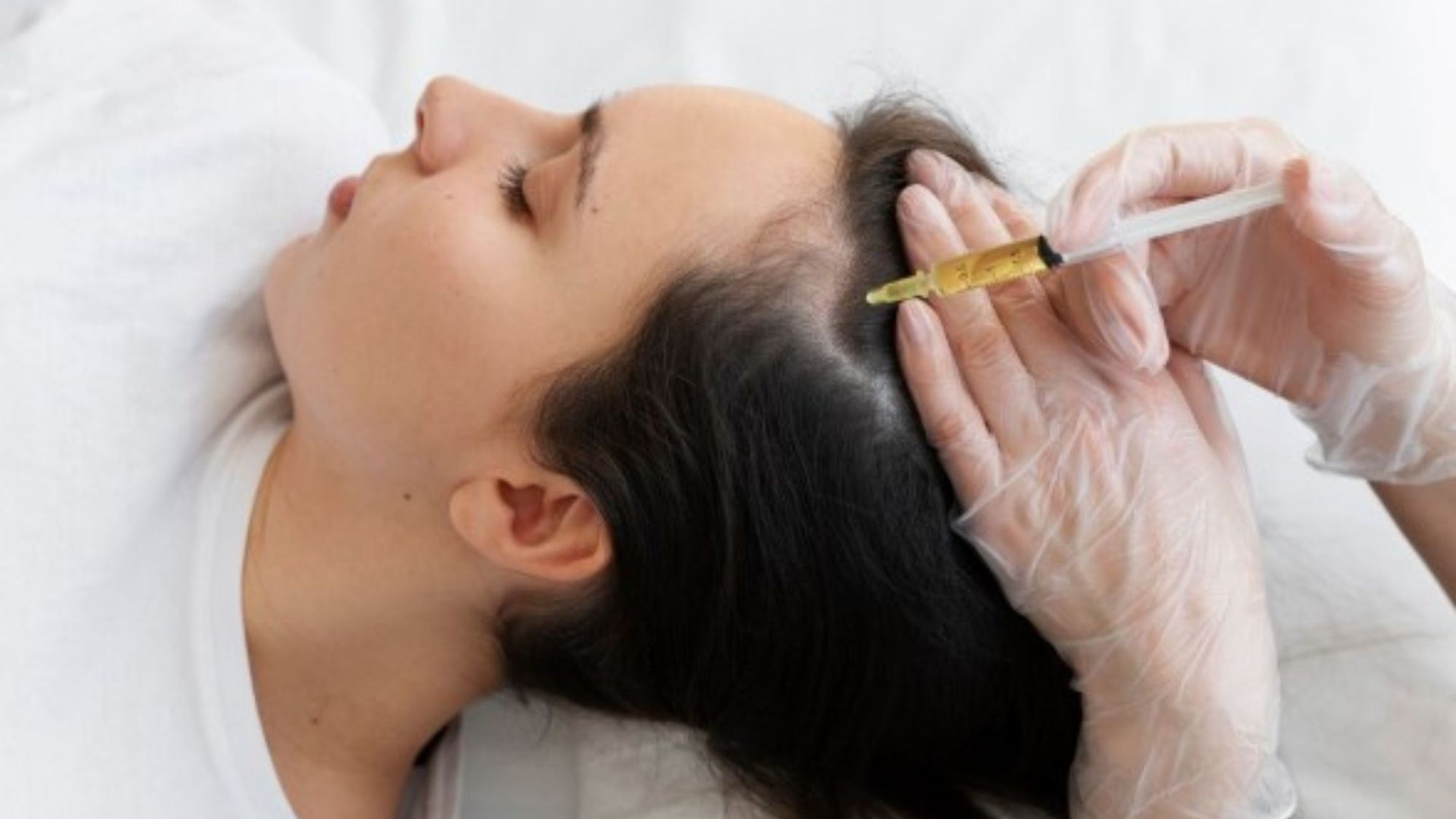 How Many Sessions of PRP Hair Treatments Do You Actually Need?