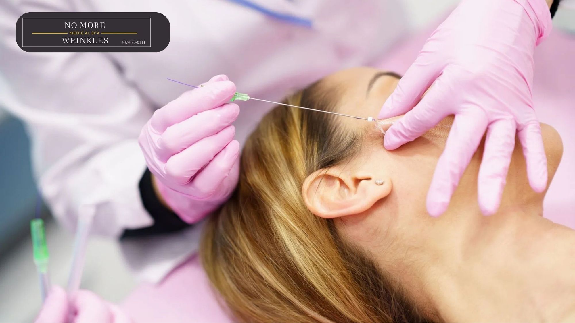 Thread Face Lift: What Should You Know Before Trying It?